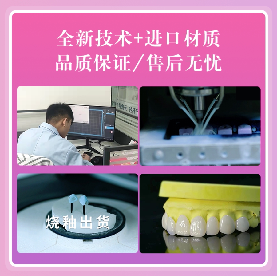 牙牙齿贴美面义获嘉全瓷牙贴片义获嘉全瓷面齿贴面贴美白牙贴白牙