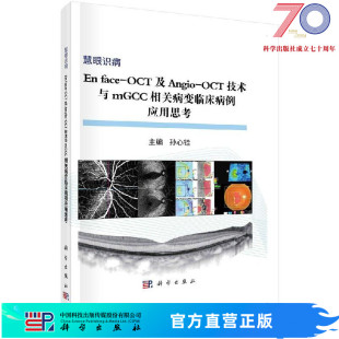 face OCT及Angio OCT技术与mGCC相关病变临床病变应用思考科学出版 社