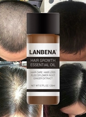 LANBENA 蓝蓓娜 Hair Growth Essential Oil 头发护理精油 20ml