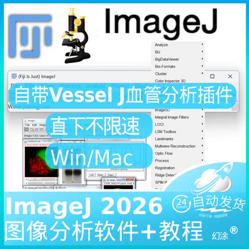 Fiji Imagej 自带VesselJ 血管成形密度分析插件Win Mac Vessel J
