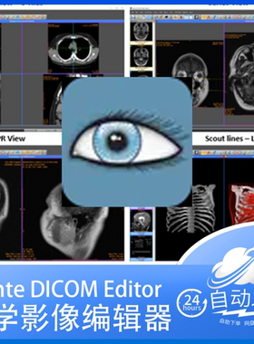 Sante DICOM Editor 8.2.4 医学影像编辑软件 永久授权