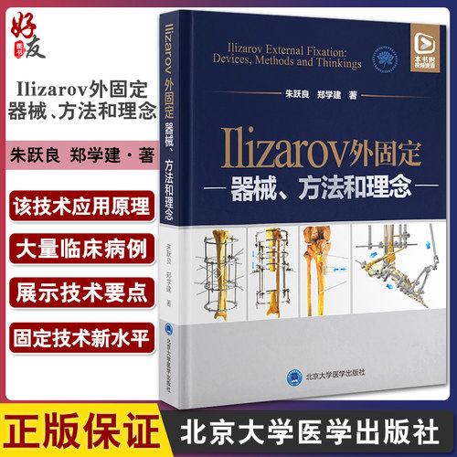 预售固定器械方法理念