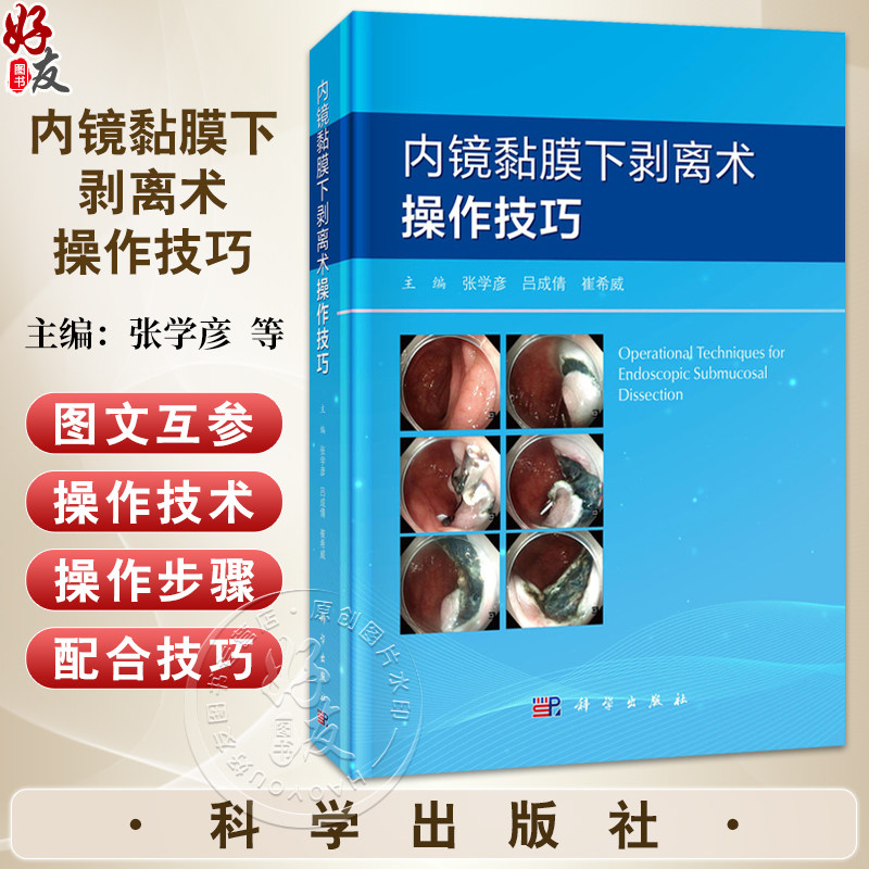 内镜黏膜下剥离术操作技巧 张学彦 吕成倩 崔希威 介绍了内镜黏膜下剥离术（ESD）操作步骤、相关常识及ESD麻醉管理等 科学出版社