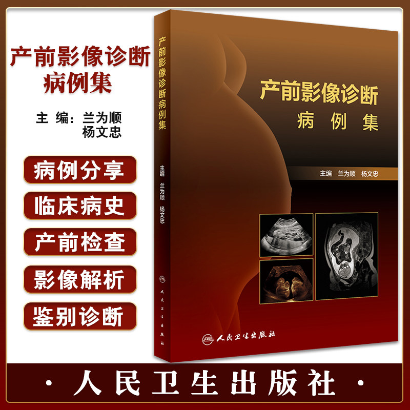 产前影像诊断病例集兰为顺杨文忠