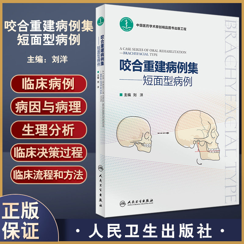咬合重建病例集短面型病例刘洋