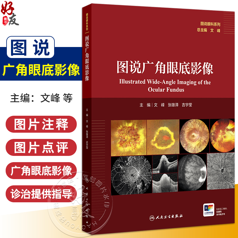 图说广角眼底影像 主编文峰 张雄泽 吉宇莹 遗传性视网膜脉络膜病变 眼底炎症与感染 视网膜血管性疾病9787117370912人民卫生出版