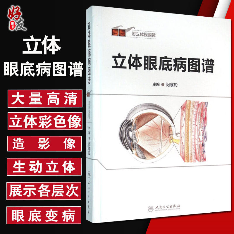 立体眼底病图谱  附立体视眼镜  闵寒毅主编 人民卫生出版社9787117212519