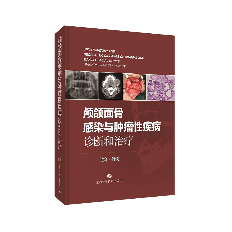 颅颌面骨感染与肿瘤性疾病诊断和治疗 何悦 口腔科学书籍 颅颌面骨常见病检查诊疗手术操作 上海科学技术出版社9787547854884