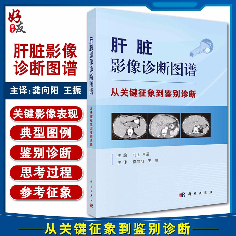 无货已下架肝脏影像诊断图谱—从关键征象到鉴别诊断临床影像阐述了从关键影像表现引导到鉴别诊断的思考过程村上卓道主编978