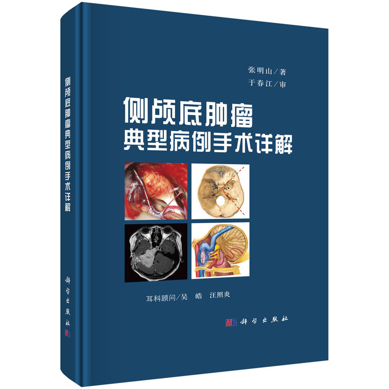 正版 侧颅底肿瘤典型病例手术详解(精) 张明山 科学出版社 9787030702753
