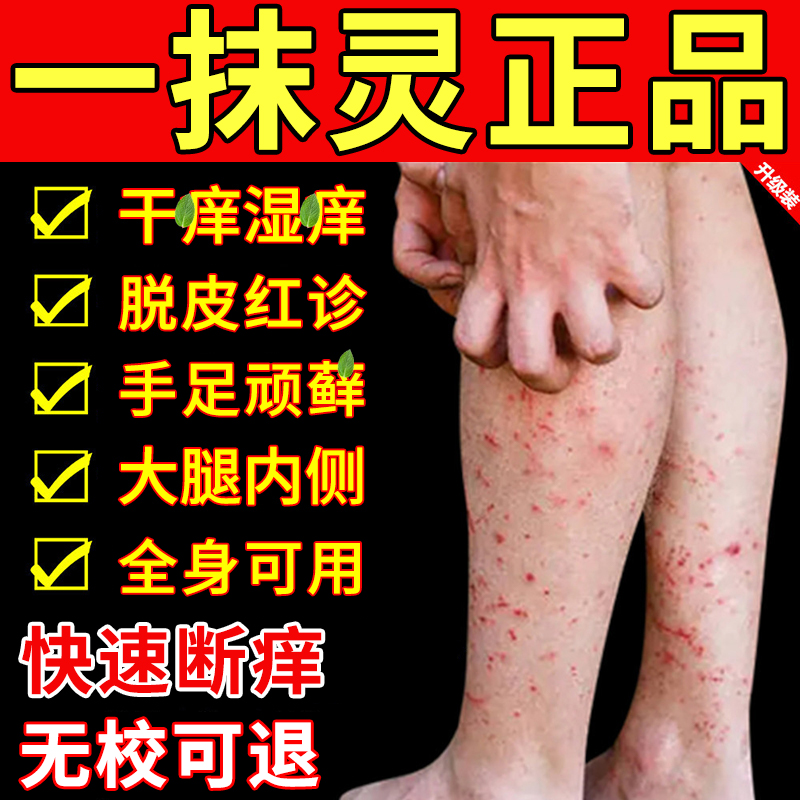 一抹灵正品官方旗舰店抑菌乳膏皮肤干痒湿痒手足顽藓外用止痒软膏
