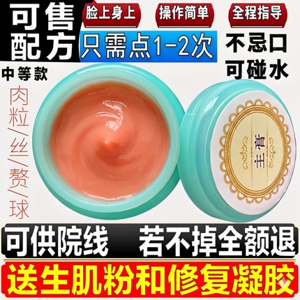 脖子小肉粒去除膏丝状扁平犹头上硬疙瘩肉刺皮赘腋下肉揪专用神器