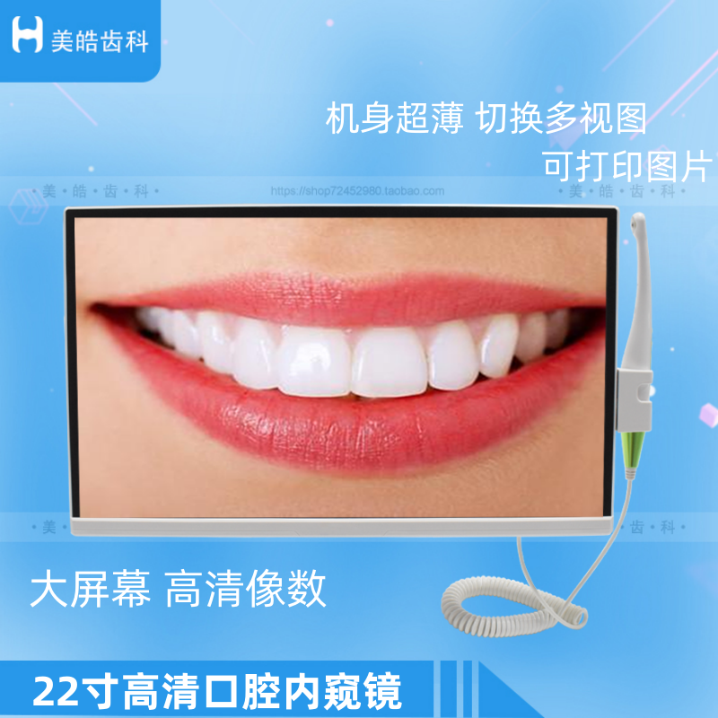 超薄内窥镜口腔观察仪打印图片