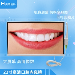 超薄内窥镜口腔观察仪打印图片