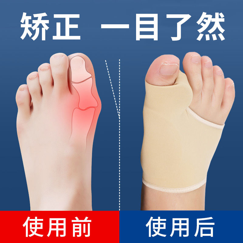 拇指外翻脚趾矫正器分趾器可穿鞋
