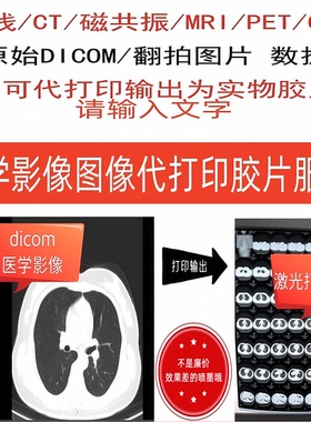 医学影像CT/MRI磁共振/DR X光线原始DICOM/DCM数据图片打印胶片