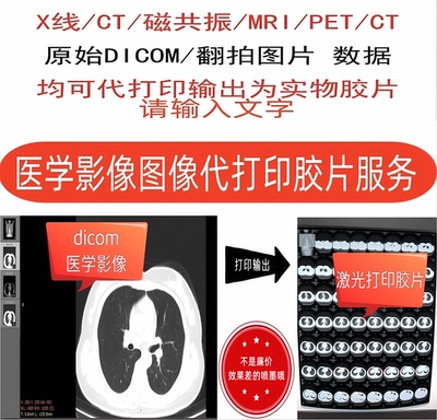 医学影像CT/MRI磁共振/DR X光线原始DICOM/DCM数据图片打印胶片
