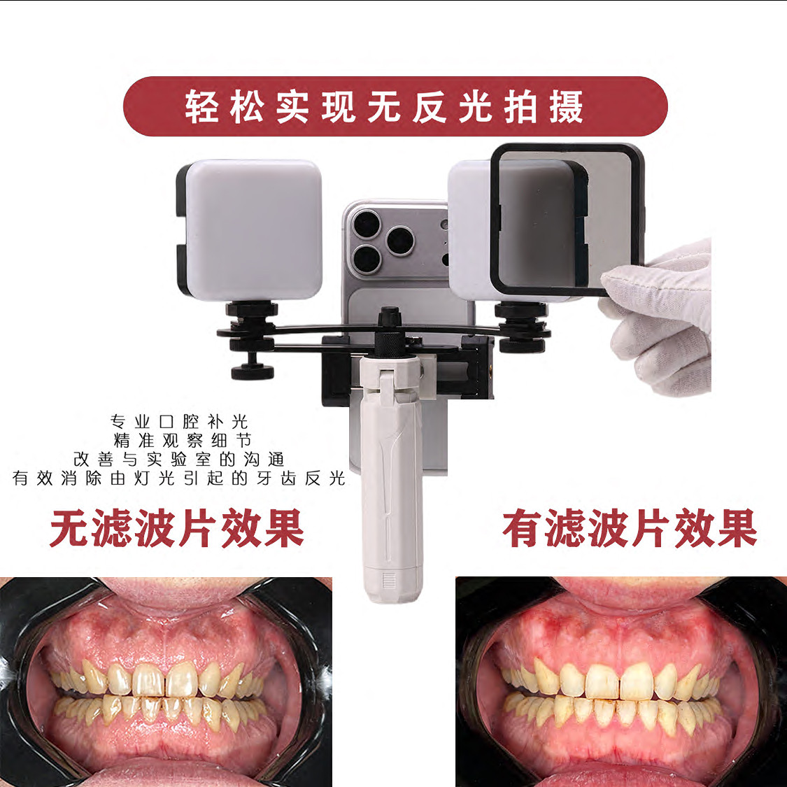 知乐仕补光灯手机牙科口腔摄影图片