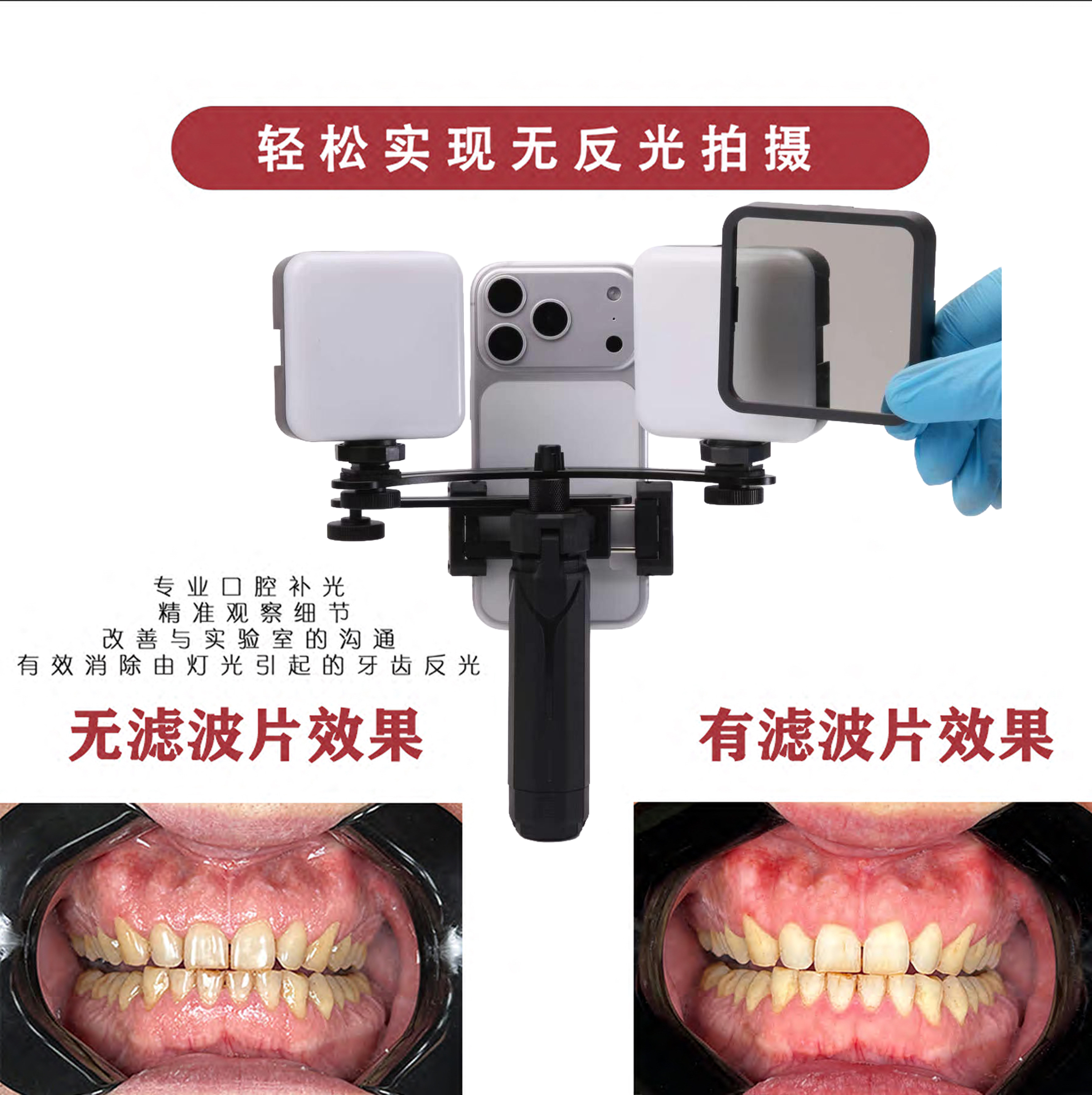 知乐仕双头手机牙科口腔补光灯图片