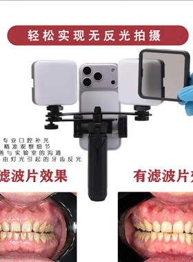 知乐仕019黑色款横竖拍手机双头微距牙科口腔摄影补光灯