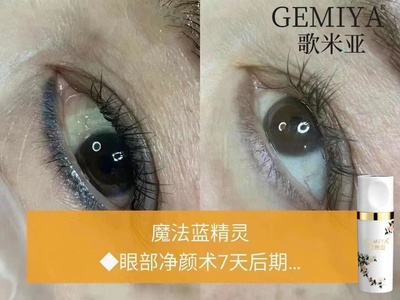 CS中国改蓝眼线还原发蓝