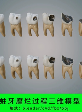 蛀牙腐烂过程三维模型3d素材blender/c4d/fbx/obj写实牙齿虫牙