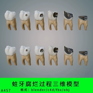 fbx obj写实牙齿虫牙 c4d 蛀牙腐烂过程三维模型3d素材blender