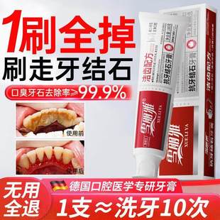 牙膏速效洗白去黄去口臭烟渍溶解牙垢清除神器专用去除牙结石