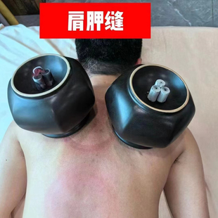 火角灸罐特大扶阳暖宫驱寒理疗养拔罐陶土砭石紫砂温阳巨型罐