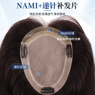 琪姐假发片女头顶补发蓬松增发量遮秃顶全真发丝轻薄透气自然前额