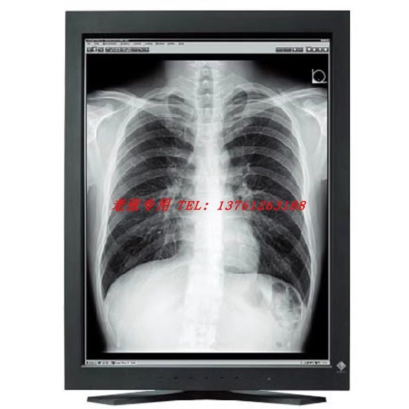 艺卓EIZO RadiForce RX370 GX560 RX660 3MP 5MP医疗液晶显示器_虎窝淘