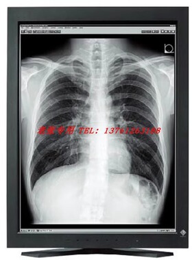 艺卓EIZO RadiForce RX370 GX560 RX660 3MP 5MP医疗液晶显示器