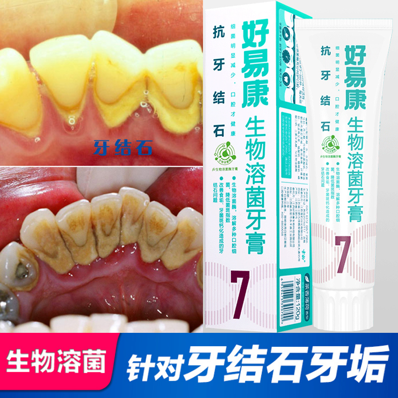 好易康生物溶菌牙膏7号去除牙结石牙菌斑清除牙垢去黑渍亮白牙齿-封面