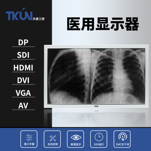 内窥胃肠镜手术灰阶医疗用显示器