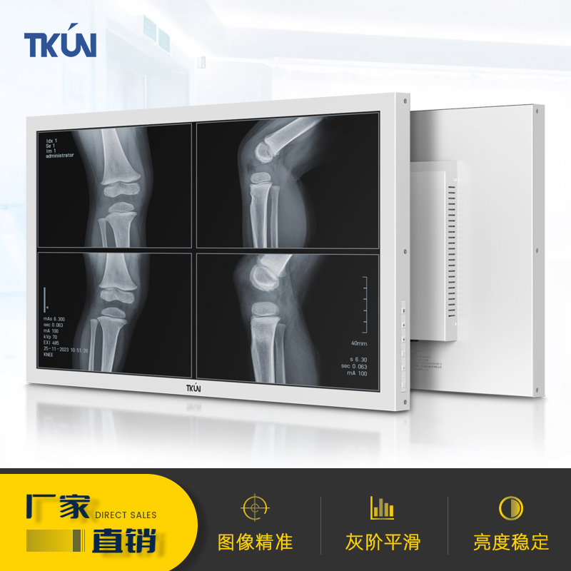 27寸内窥镜诊断医用显示器