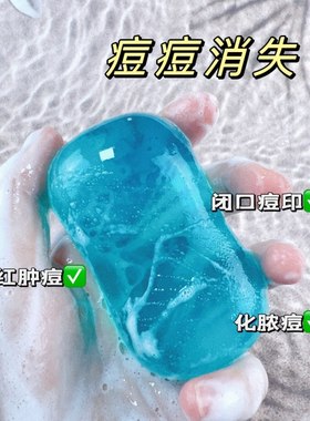 水杨酸洁面皂除痘印净螨手工皂