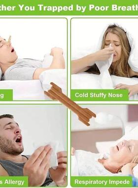 10/50PCS Breath Nasal Strips Right Aid Stop Snoring Nose Pat