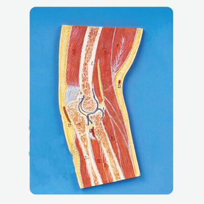 肘关节剖面模型A11203