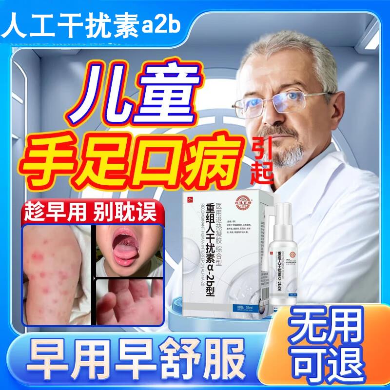 手足口病搭药重组人工干扰素a2b喷雾剂儿童疱疹性膏咽峡炎口腔α