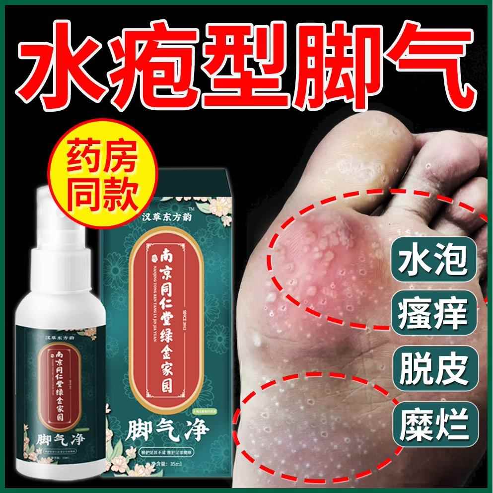 日本去菌除脚气喷雾止痒脱皮去烂脚丫根杀药膏水泡脚汗臭神器正品