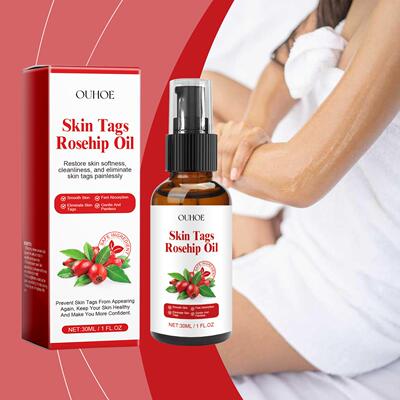 OUHOE Rosehip Seed Skin Tag Essential Oil Skin Care Cleansin