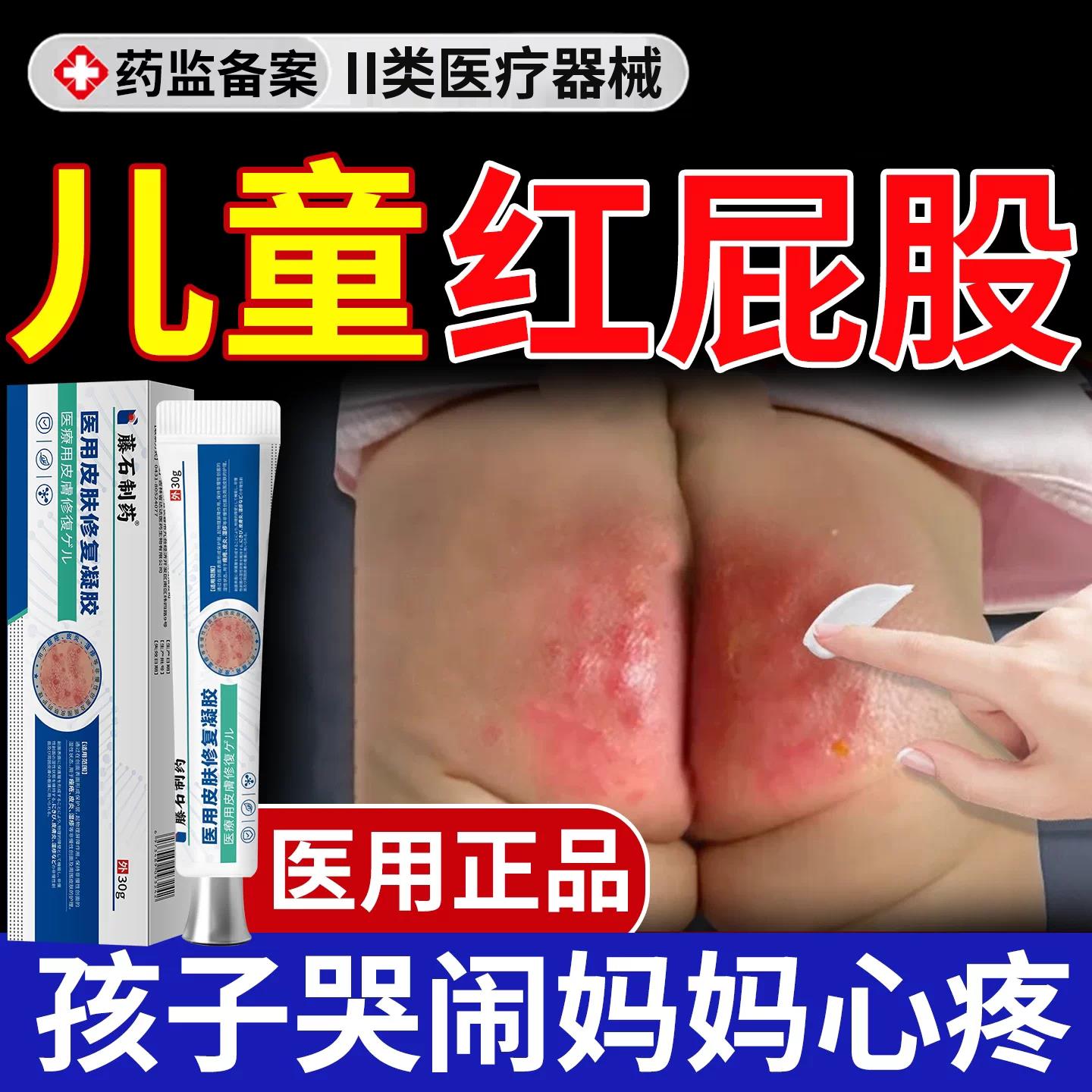 儿童红屁股尿布疹婴幼无激素红肿痒红屁股湿疹医用级药膏儿QK医星