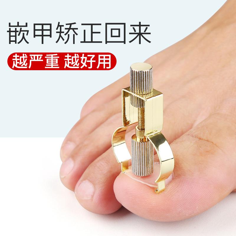 甲沟矫正器嵌甲脚指甲钳修甲套装修脚刀工具甲勺指卷甲卷矫正器炎