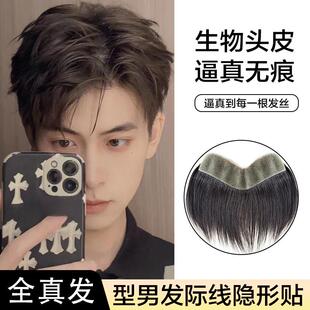 发际线假发贴男士浏海M型生物头皮自然前额轻薄真发补发片假发片