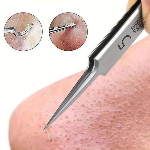 1 Pack Extra Fine No. 5 Cellular Acne Blackhead Tweezers - F