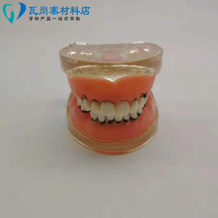 牙周病理模型 练习牙结石刮治模型 刮治器练习软牙龈牙可换  包邮