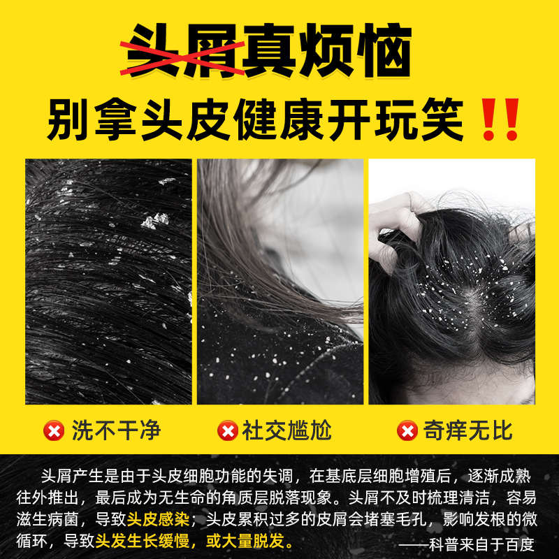 篦子梳去头屑超密齿细齿梳子刮头皮屑清理除头虱加密虱子金小