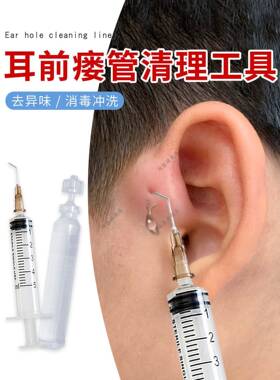 耳前瘘管清理工具清洁耳瘘流脓耳仓发炎肿耳朵弯头外耳道洗耳针头