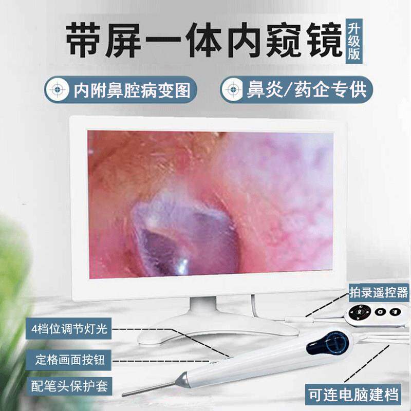 10寸高清可视耳镜内窥镜设备耳鼻喉检测仪 可拍照录影耳镜检测仪