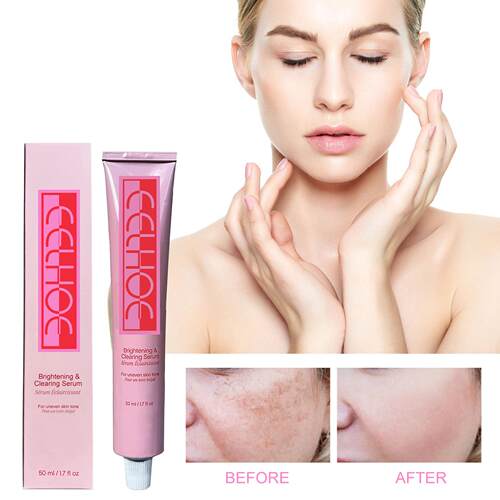 EELHOE Dark Spot Essence Lotion: Skin care for spots, melani
